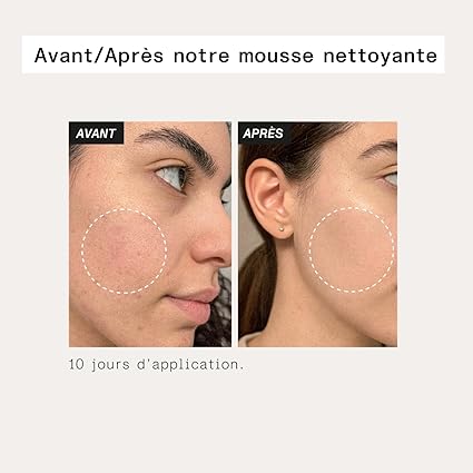 Aloe Paris Gentle Cleansing Foam – 100 ml