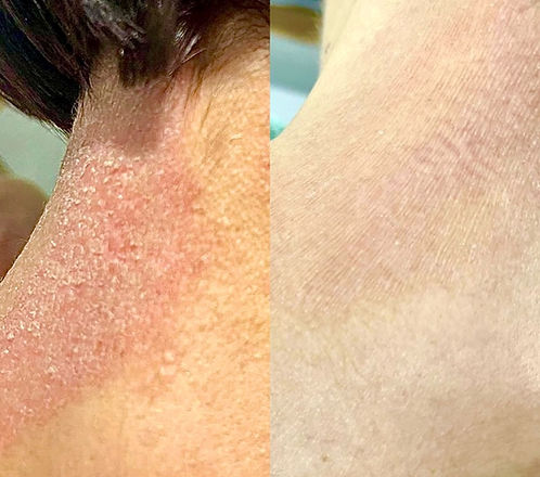 Derma Douce Plus 15% Urea