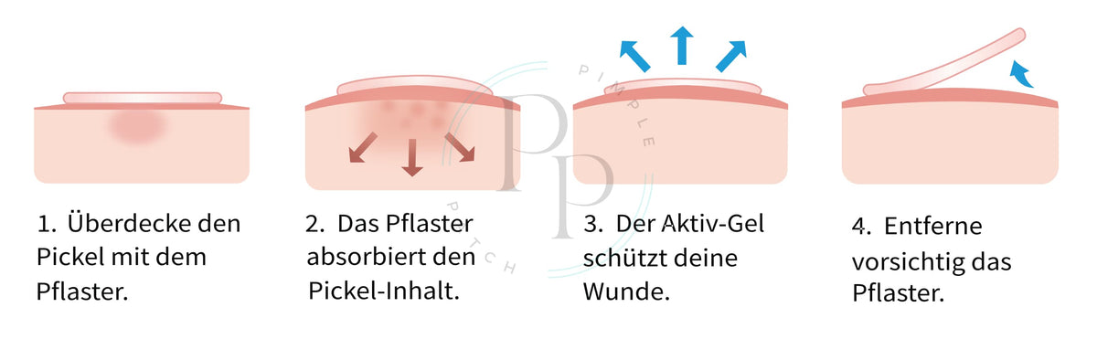 Pickel Pflaster COSRX - Das Allround-Pflaster des Marktführers